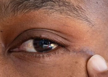 Brain Tumor Through Eye Socket in Groundbreaking Surgery - Tech News Today
